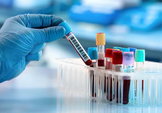 深圳体检代检解读血常规结果，了解异常原因和预防方法